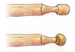 wooden sticks carved into mushroom shapes